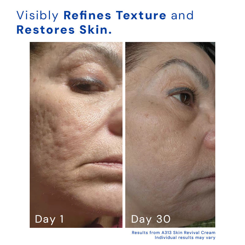 Zanedo - Skin Revival Cream