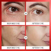 SkinRenew Korean Serum