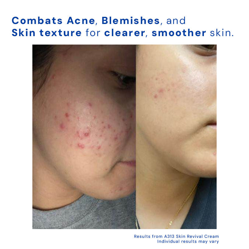 Zanedo - Skin Revival Cream