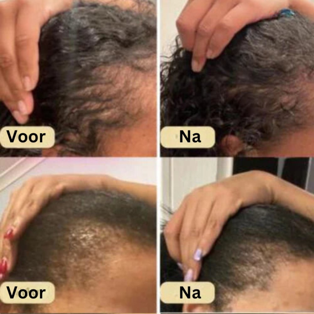Veganic Haar Groei Boost Olie
