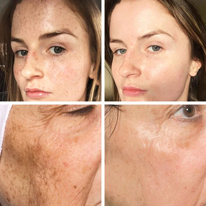 Spotless Glow Serum