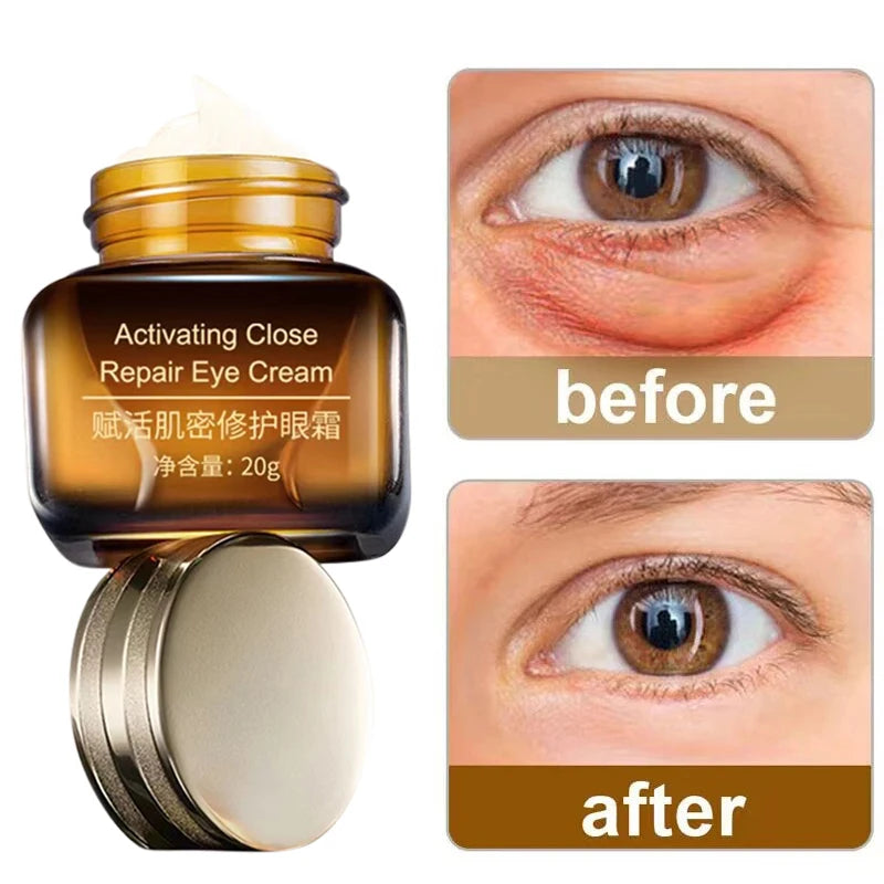 Radiance Reserve - Oogcrème Wonder