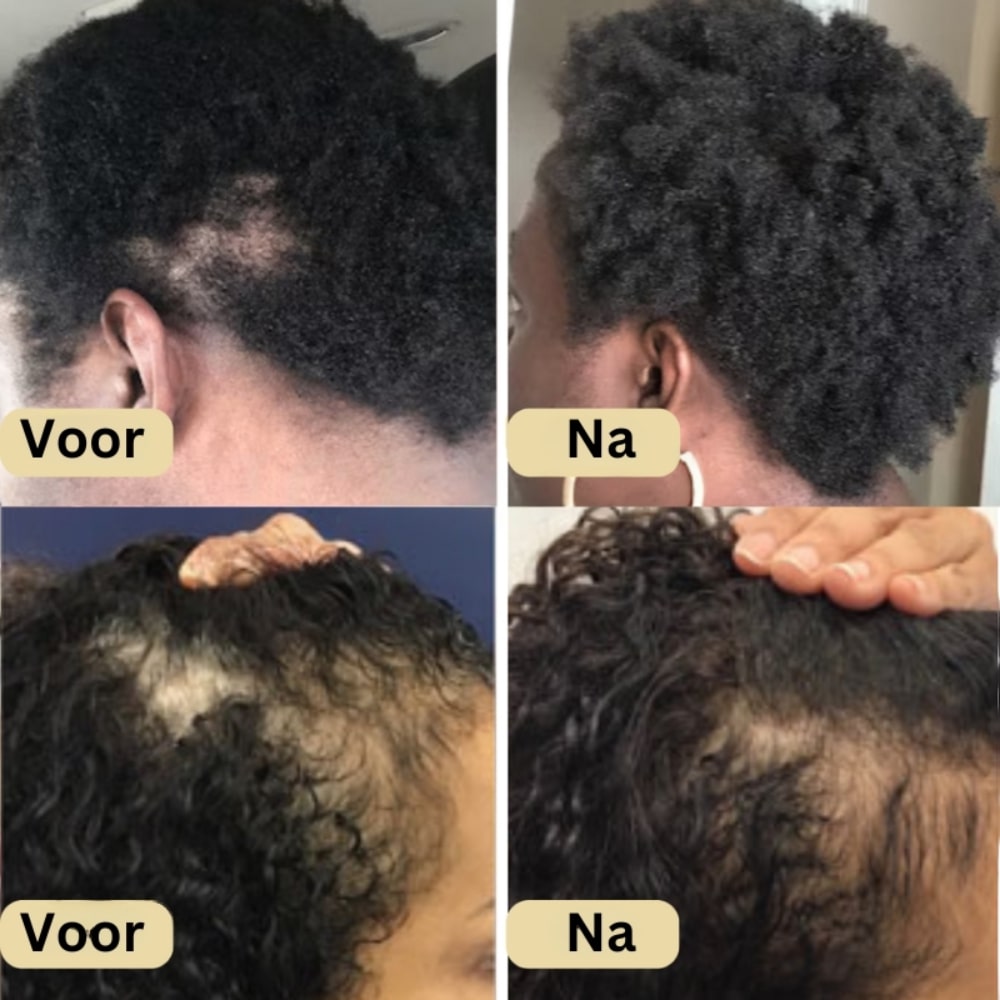 Veganic Haar Groei Boost Olie