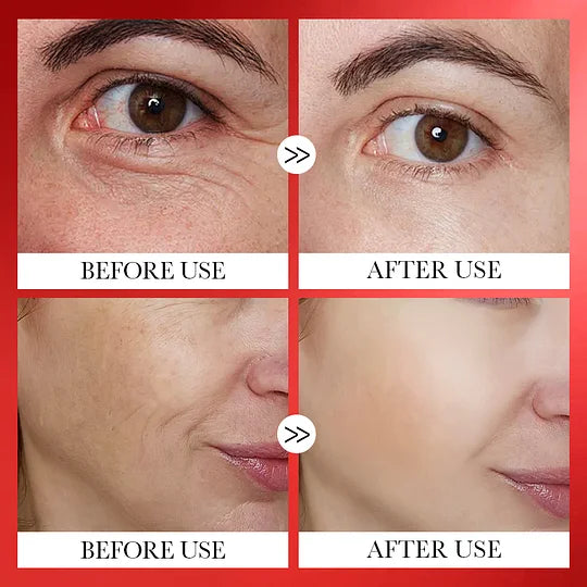 SkinRenew Korean Serum