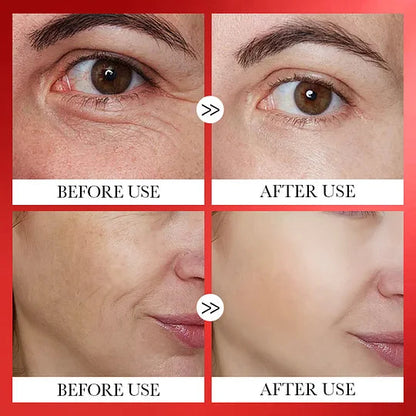 SkinRenew Korean Serum