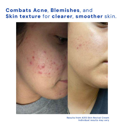 Zanedo - Skin Revival Cream
