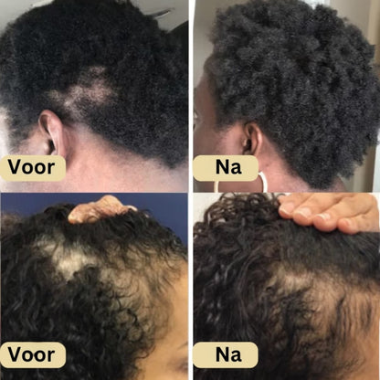 Veganic Haar Groei Boost Olie